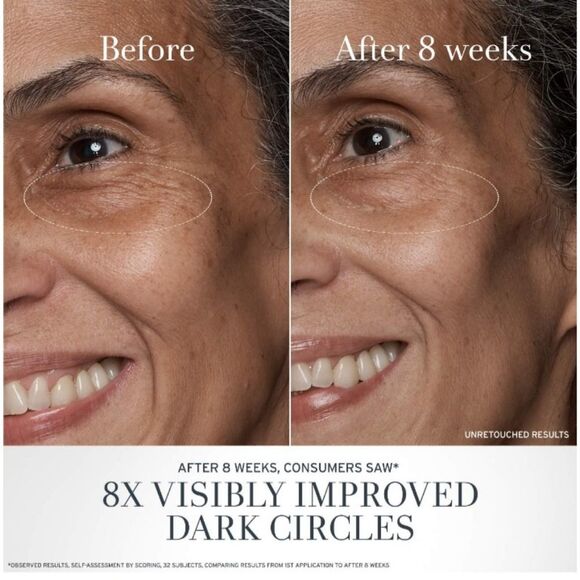 FRESH Black Tea Advanced Age Renewal Anti-Aging Eye Cream - Picture 3 of 8